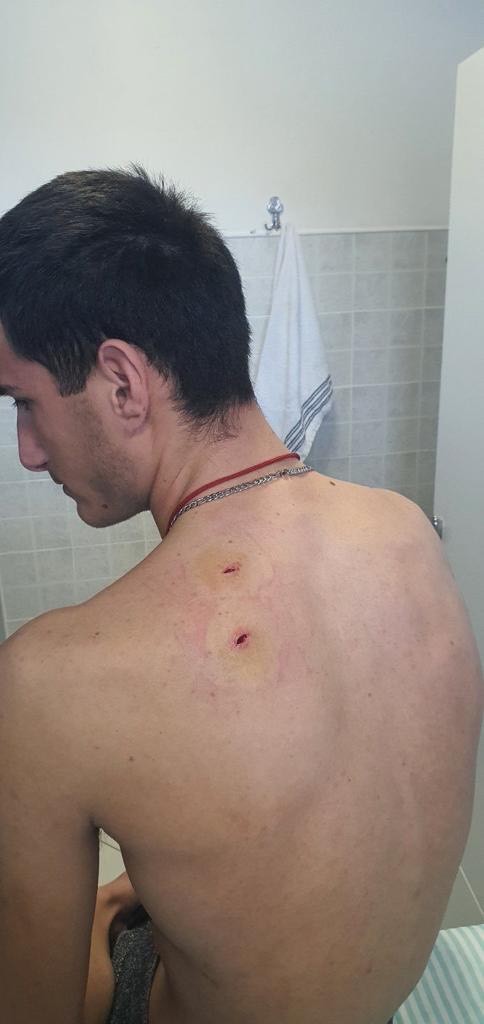 Group of Albanians attack young Serb in Mogila